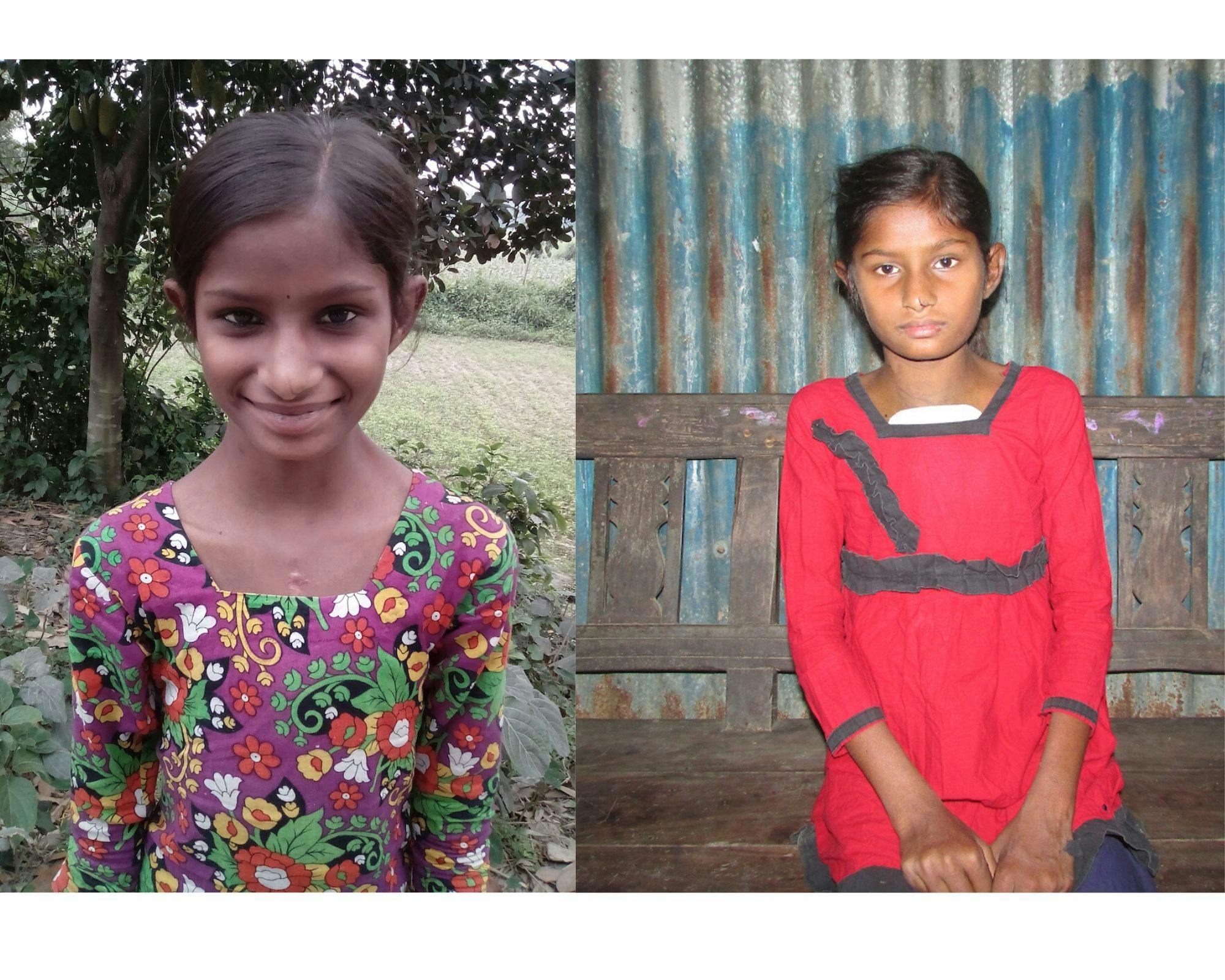 Portrait of a girl before and after open heart surgery